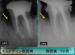 処置前後の比較