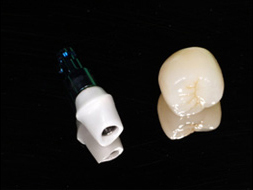 インプラントに入れた人工歯の写真 Before
